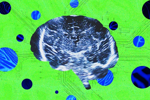 A New Neurotech Startup Launches to Rival Sam Altman’s Merge Labs