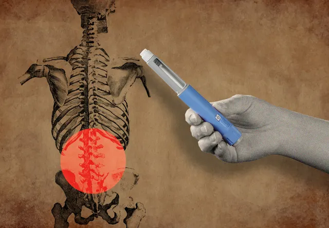 GLP-1s could offer unexpected relief from back and knee pain, but doctors urge caution
