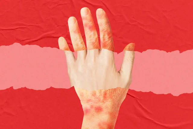 A New Anti-Aging Drug Looks to Turn Back the Clock on Skin Age